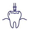 Dental Sealants